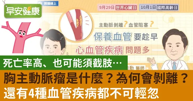 胸主動脈瘤是什麼？為何會剝離？還有4種血管疾病都不可輕忽