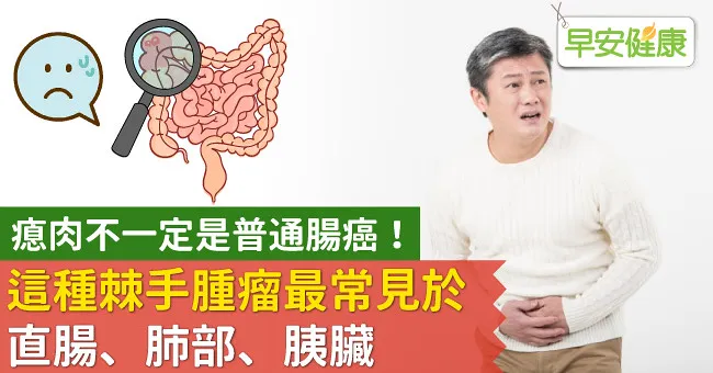 瘜肉不一定是普通腸癌！這種棘手腫瘤最常見於直腸、肺部、胰臟