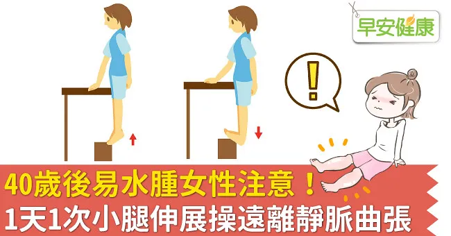40歲後易水腫女性注意！1天1次小腿伸展操遠離靜脈曲張
