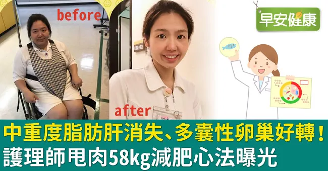 中重度脂肪肝消失、多囊性卵巢好轉！護理師甩肉58kg減肥心法曝光