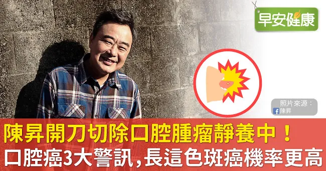 陳昇開刀切除口腔腫瘤靜養中！口腔癌3大警訊，長這色斑癌機率更高