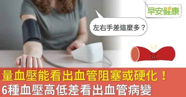 量血壓能看出血管阻塞或硬化！6種血壓高低差看出血管病變