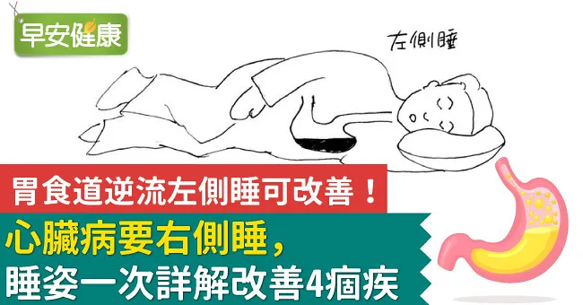 胃食道逆流左側睡可改善！心臟病要右側睡，睡姿一次詳解改善4痼疾