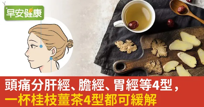 頭痛分肝、膽、胃、膀胱經4型，一杯桂枝薑茶4型都可緩解