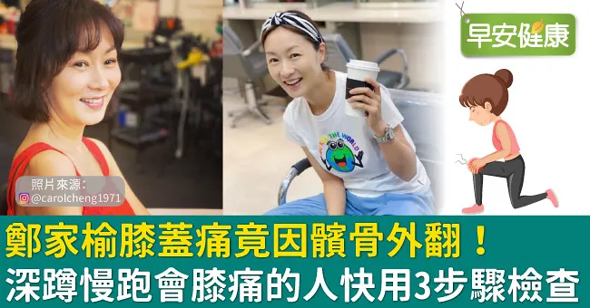鄭家榆膝蓋痛竟因髕骨外翻！深蹲慢跑會膝痛的人快用3步驟檢查