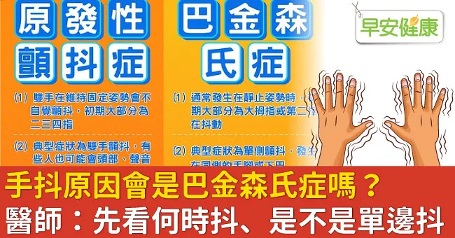 手抖原因會是巴金森氏症嗎？醫師：先看何時抖、是不是單邊抖