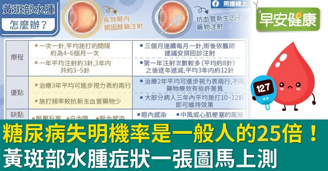 糖尿病失明機率是一般人的25倍！黃斑部水腫症狀一張圖馬上測