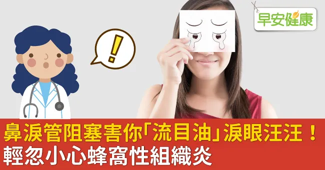 鼻淚管阻塞害你「流目油」淚眼汪汪！輕忽小心蜂窩性組織炎