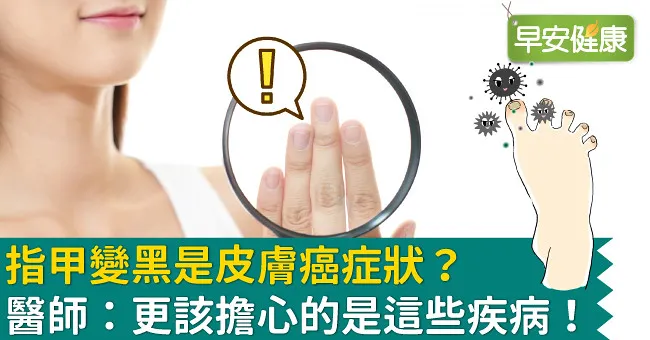 指甲變黑是皮膚癌症狀？醫師：更該擔心的是這些疾病！