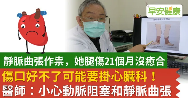 傷口好不了可能要掛心臟科！醫師：小心動脈阻塞和靜脈曲張