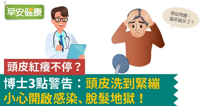 頭皮紅癢不停？博士3點警告：頭皮洗到緊繃小心開啟感染、脫髮地獄！