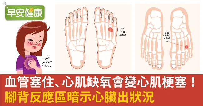 血管塞住、心肌缺氧會變心肌梗塞！腳背反應區暗示心臟出狀況