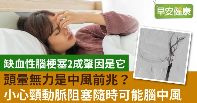 頭暈無力是中風前兆？小心頸動脈阻塞隨時可能腦中風