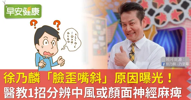 徐乃麟「臉歪嘴斜」原因曝光！醫教1招分辨中風或顏面神經麻痺