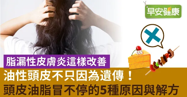 油性頭皮不只因為遺傳！頭皮油脂冒不停的5種原因與解方