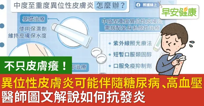 異位性皮膚炎可能伴隨糖尿病、高血壓！醫師圖文解說如何抗發炎