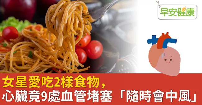 女星愛吃2樣食物，心悸檢查竟9處血管堵塞「隨時會中風」