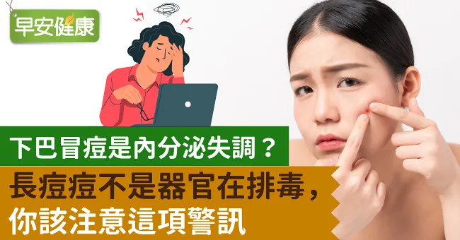 下巴冒痘是內分泌失調？長痘痘不是器官在排毒，你該注意這項警訊