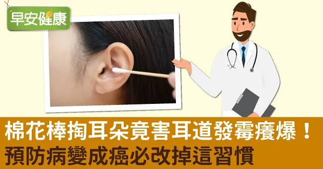 棉花棒掏耳朵竟害耳道發霉癢爆！預防病變成癌必改掉這習慣