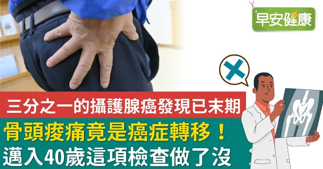 骨頭痠痛竟是癌症轉移！邁入40歲這項檢查做了沒