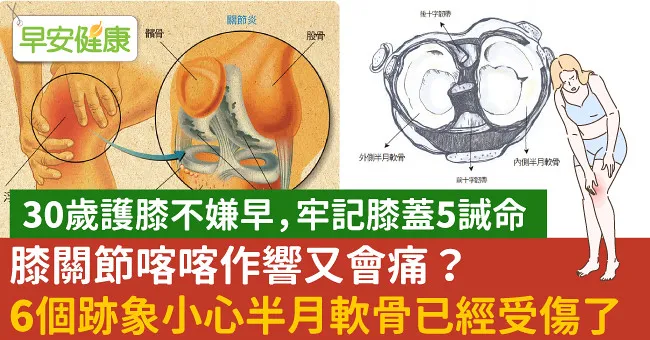 膝關節喀喀作響又會痛？6個跡象小心半月軟骨已經受傷了