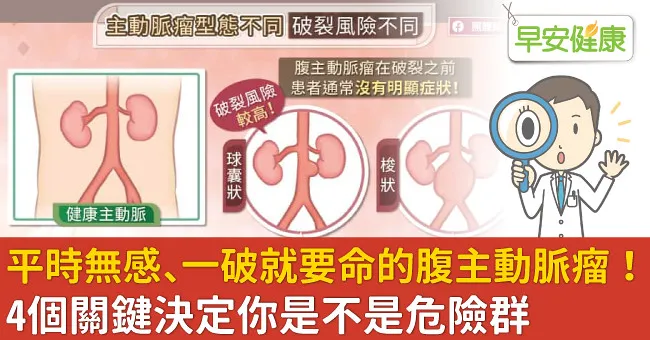 平時無感、一破就要命的腹主動脈瘤！4個關鍵決定你是不是危險群