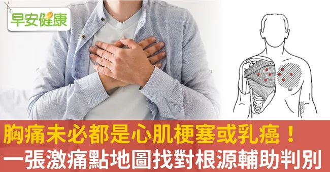 胸痛未必都是心肌梗塞或乳癌！一張激痛點地圖找對根源輔助判別
