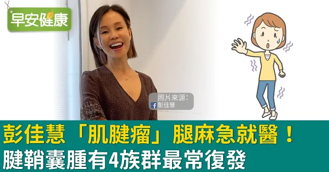 彭佳慧「肌腱瘤」腿麻急就醫！腱鞘囊腫有4族群最常復發
