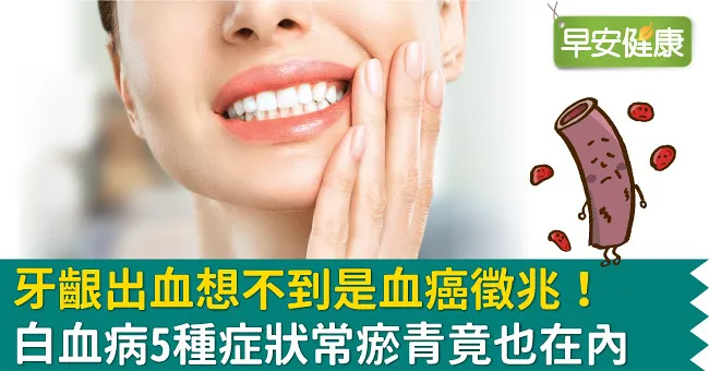 牙齦出血想不到是血癌徵兆！白血病5種症狀常瘀青竟也在內