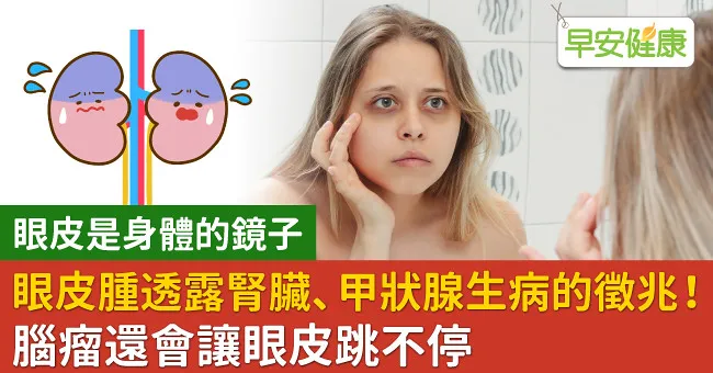 眼皮腫透露腎臟、甲狀腺生病的徵兆！腦瘤還會讓眼皮跳不停