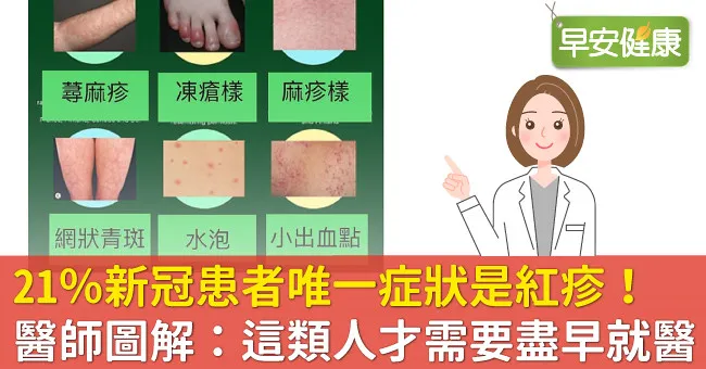 21％新冠患者唯一症狀是紅疹！醫師圖解：這類人才需要盡早就醫