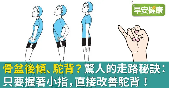 骨盆後傾、駝背？驚人的走路秘訣：只要握著小指，直接改善駝背！