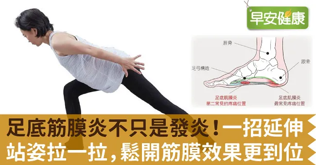 足底筋膜炎不只是發炎！一招延伸站姿拉一拉，鬆開筋膜效果更到位