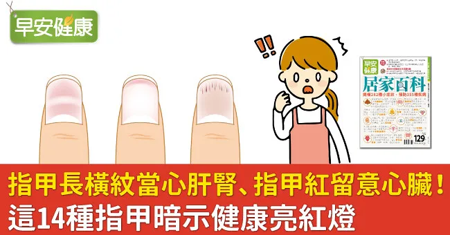 指甲長橫紋當心肝腎、指甲紅留意心臟！這14種指甲暗示健康亮紅燈