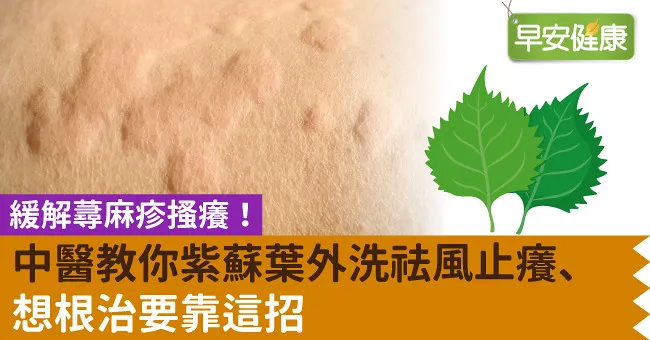 緩解蕁麻疹搔癢！中醫教你紫蘇葉外洗祛風止癢、想根治要靠這招