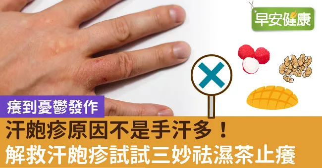 汗皰疹原因不是手汗多！解救汗皰疹試試三妙祛濕茶止癢