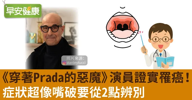 《穿著Prada的惡魔》演員證實罹癌！症狀超像嘴破要從2點辨別