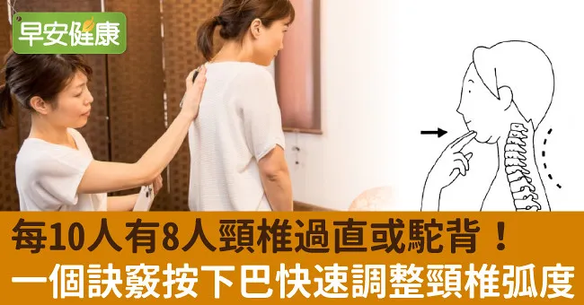 每10人有8人頸椎過直或駝背！一個訣竅按下巴快速調整頸椎弧度