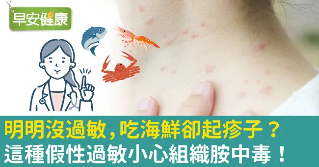明明沒過敏，吃海鮮卻起疹子？這種假性過敏小心組織胺中毒！