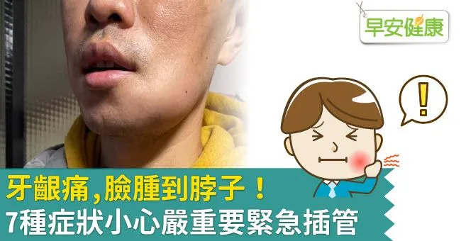 牙齦痛，臉腫到脖子！7種症狀小心嚴重要緊急插管