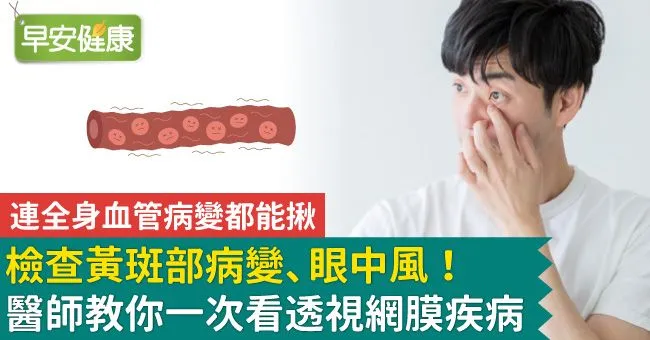 檢查黃斑部病變、眼中風！醫師教你一次看透視網膜疾病
