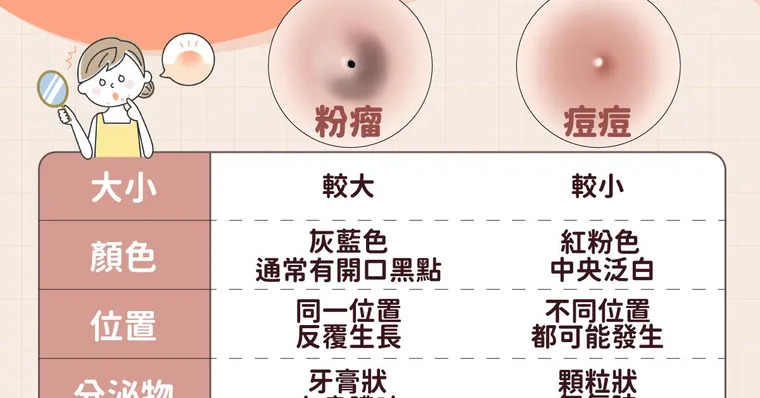 粉瘤會自己消嗎？粉瘤和痘痘差別、手術費用與治療全攻略