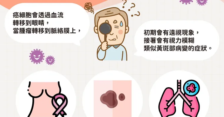 31歲視力模糊看眼科才知罹肺癌！5種眼睛症狀竟是「癌症」轉移到眼睛