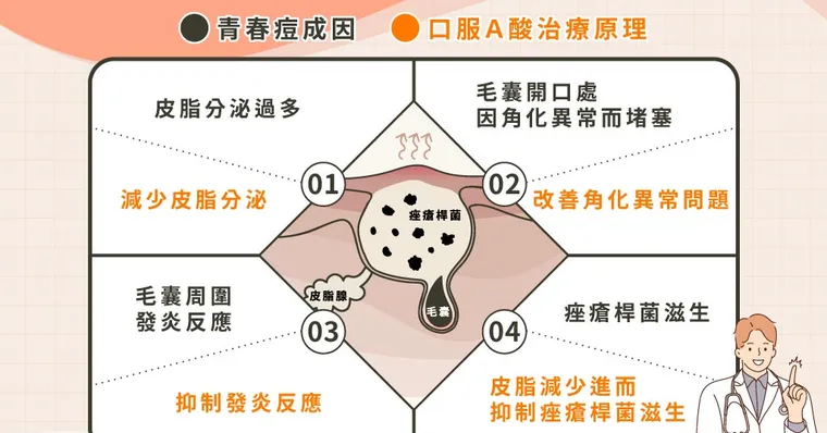 青春痘狂冒長不停！口服A酸拯救豆花臉