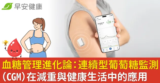 血糖管理進化論：連續型葡萄糖監測「CGM」在減重與健康生活中的應用