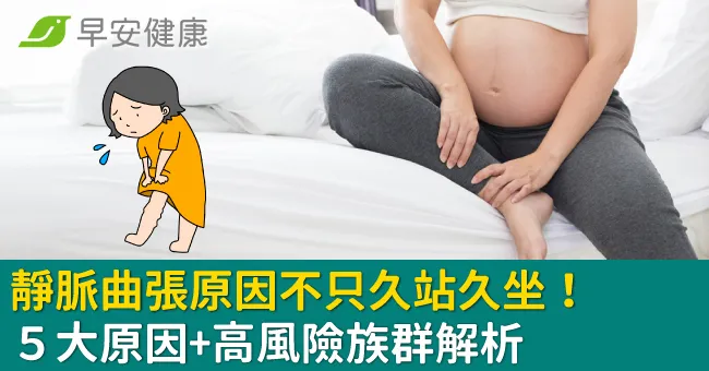 靜脈曲張原因不只久站久坐！５大原因+高風險族群解析