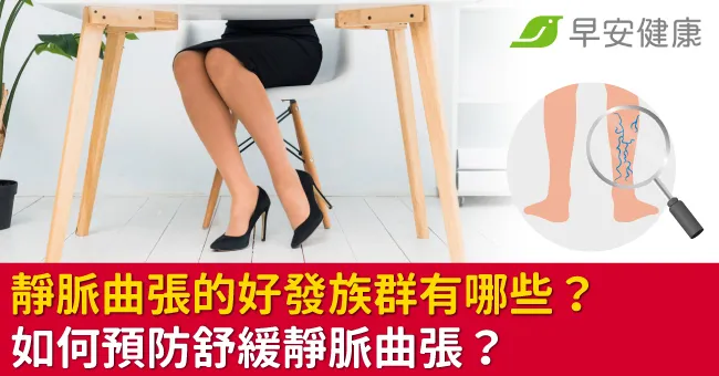 靜脈曲張的好發族群有哪些？如何預防舒緩靜脈曲張？