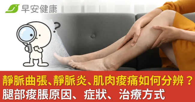 靜脈曲張、靜脈炎、肌肉痠痛如何分辨？腿部痠脹原因、症狀、治療方式