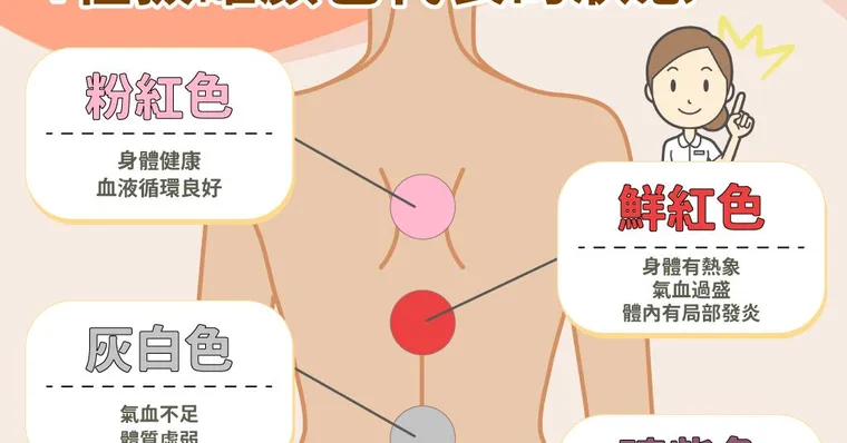 拔罐顏色代表什麼？拔罐禁忌、原理與功效總整理