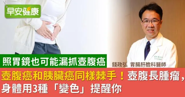 壺腹癌和胰臟癌同樣棘手！壺腹長腫瘤，身體用3種「變色」提醒你